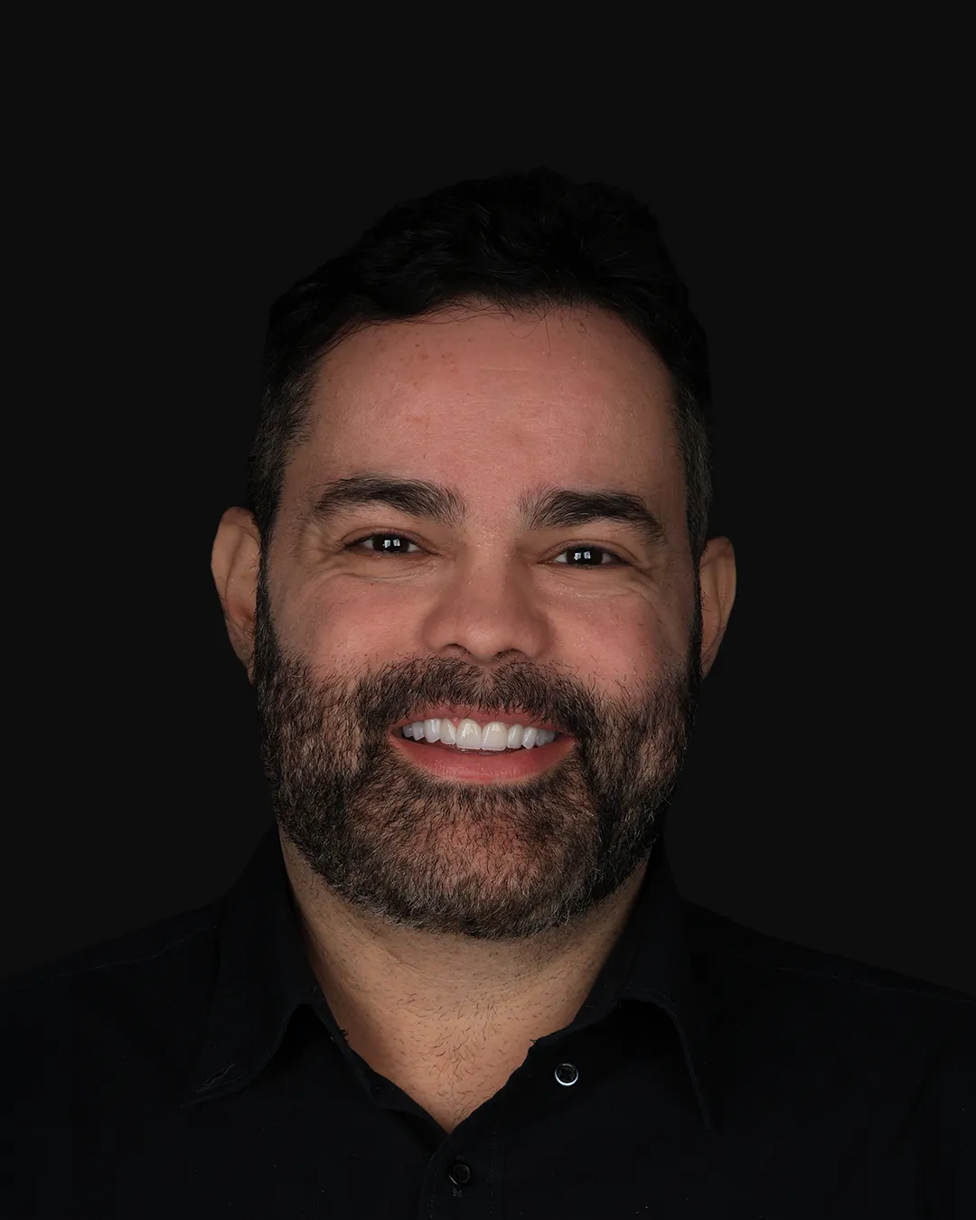 Depois: sorriso com lentes de contato dental — caso 2