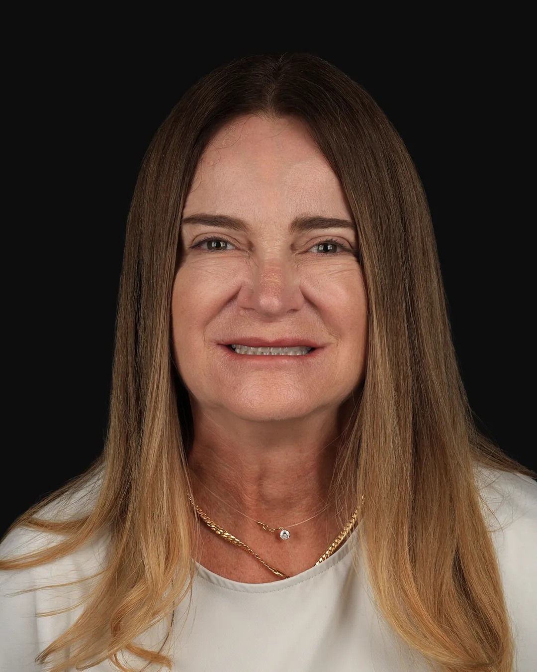 Antes: sorriso antes das lentes de contato dental — caso 4